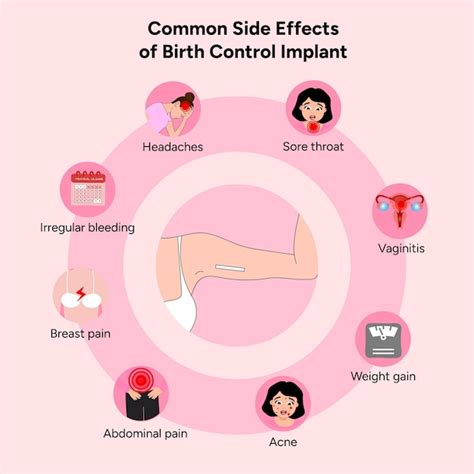 Premium Vector | Common side effects from birth control implant in vector