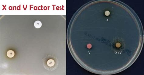 X and V Factor Test: Principle, Procedure, Results