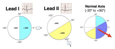 Quick Way To Determine Axis - HOLLIE STRAKER