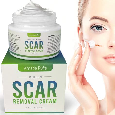 Best Scar Cream Buyers Guide 2020 - ReviewThis