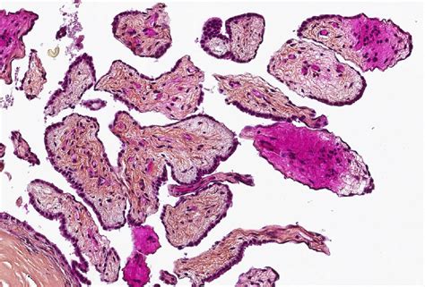 Mesothelium Histology