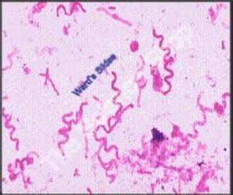 Spirillum volutans (sm) Gram found in stagnant waters - Microbiology ...