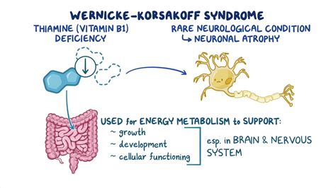 Wernickes Encephalopathy