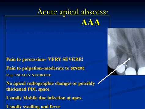 Acute Apical Abscess Radiograph