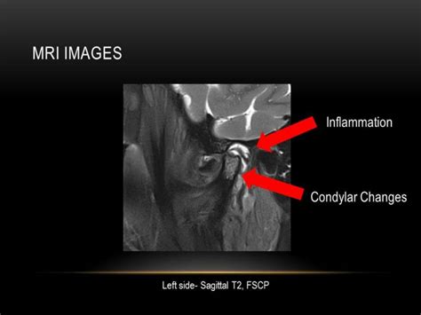 Assessment of TMJ issues via Imaging