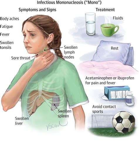 EBV Epstein Barr Virus Mononucleosis MONO - NutriMedical