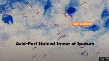 Acid-Fast Stain: Introduction, Principle, Procedure, Result Interpretation