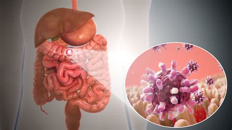 Gastroenteritis | HasnaHarmaya