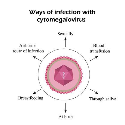 Cytomégalovirus Maladies Causées Par Le Cytomégalovirus Infographie ...