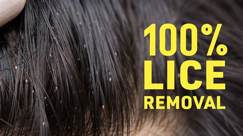 Get Rid Of Lice COMPLETELY | Safe & Natural Home Remedies For Lice ...