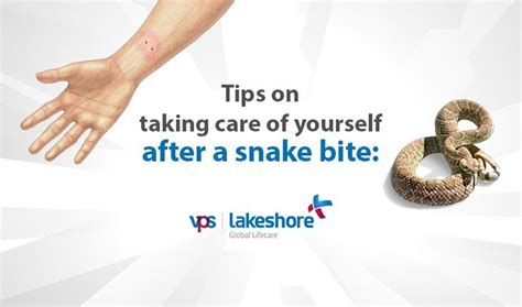 Tips on taking care of yourself after a snake bite - VPS Lakeshore