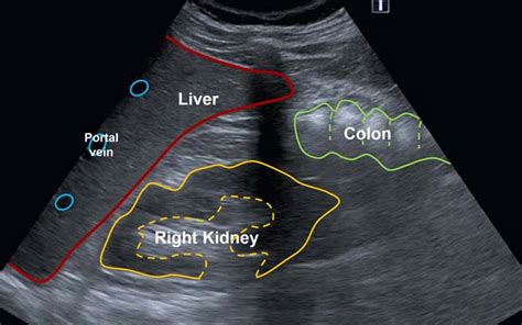 Abdomen anatomy - Radiology Cafe