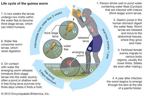 Guinea worm disease | Definition, Infection, Treatment, & Eradication ...