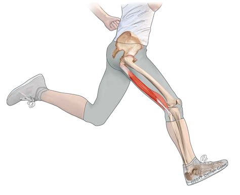 Hamstring Injuries | Biceps Femoris | Semitendinosus | Semimembranosus