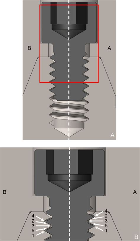 Schematic illustration of ROIs on each side of prosthetic screws. A ...