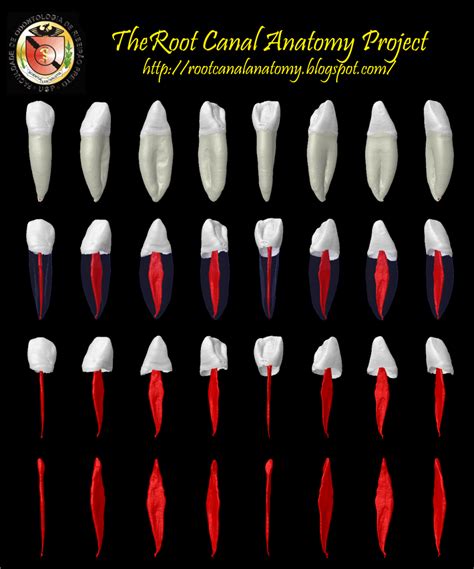 The Root Canal Anatomy Project: Mandibular Incisors