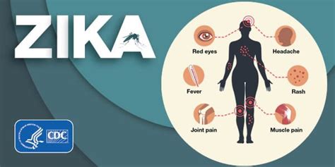 Symptoms | Zika virus | CDC