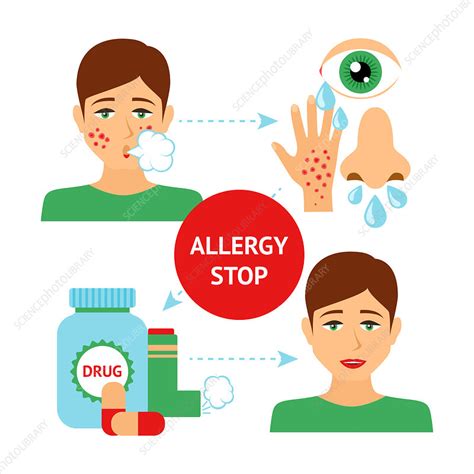 Allergy treatment, illustration - Stock Image - F019/9136 - Science ...