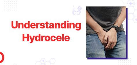 Understanding Hydrocele: Causes, Symptoms, and Treatment Options in ...