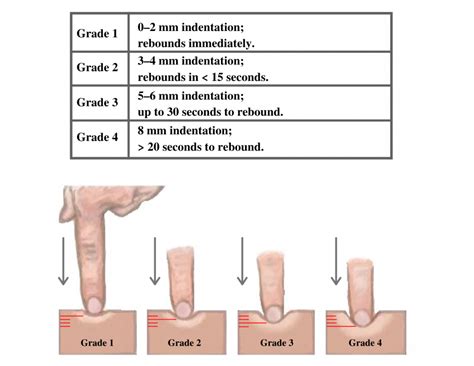 8.3: Cardiovascular Assessment - Medicine LibreTexts