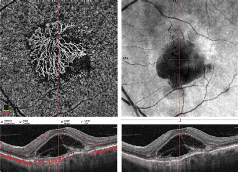 Macular Research on the Move - Retina Today