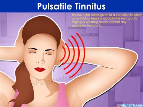 pulsatile-tinnitus - Pulsatile Tinnitus