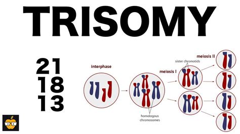 Edwards Syndrome Trisomy 18 Causes Symptoms And Types