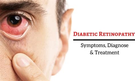 What are the symptoms of diabetic retinopathy? - FITPAA