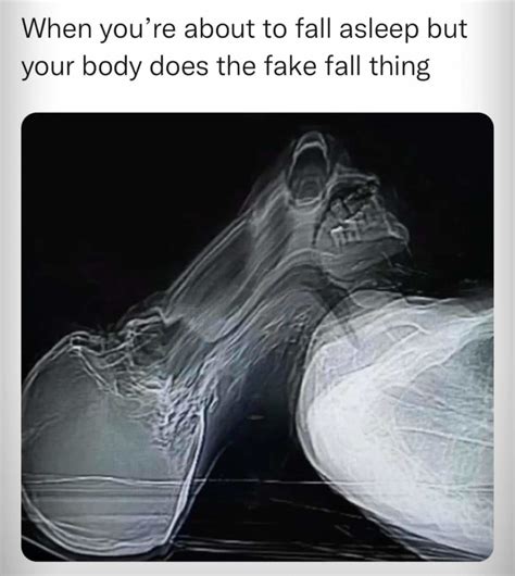 What is this xray tho - Meme subido por YourOtherLeft :) Memedroid