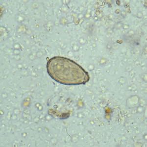 Clonorchis sinensis - Classification, Habitat, Morphology, Epidemiology ...