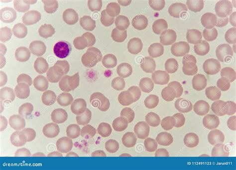 Lymphocyte Cell In Human Blood Smear Stock Image | CartoonDealer.com ...