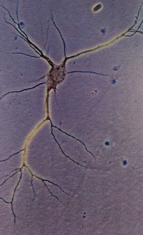 #microscopy on Tumblr | Microscopic photography, Science nature, Neurons