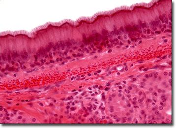 Nonciliated Pseudostratified Columnar Epithelium