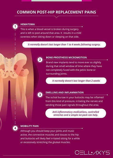 The Cause Of Buttock Pain After Hip Replacement - Cellaxys