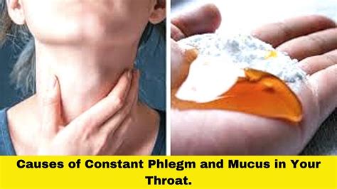 Causes of Constant Phlegm and Mucus in Your Throat || Constantly Cleari ...