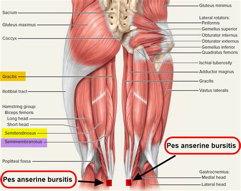 Pes anserine bursitis symptoms - hiveloxa