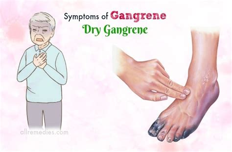 Top 6 Common Signs & Symptoms Of Gangrene Disease In Legs, Hands