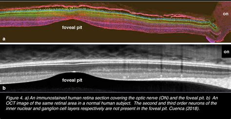 Fovea Histology