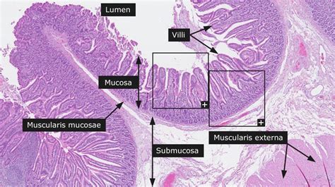 Dictionary - Normal: Small intestine - The Human Protein Atlas | Human ...