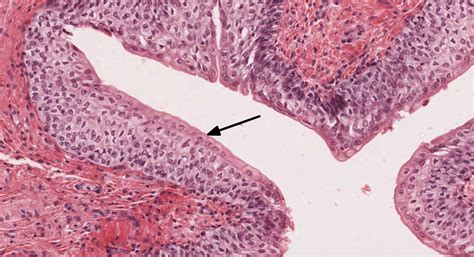 Epithelial Tissue | histology