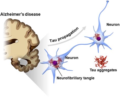 | Propagation of tau pathology in Alzheimer's disease (AD) brain. The ...