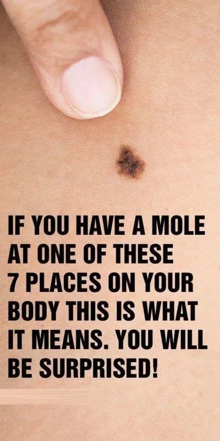 IF YOU HAVE A MOLE AT ONE OF THESE 7 PLACES ON YOUR BODY THIS IS WHAT ...