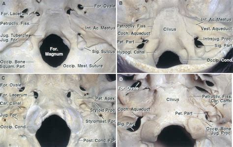 Jugular Foramen | The Neurosurgical Atlas