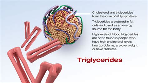 High triglycerides causes, symptoms, high triglycerides diet and treatment