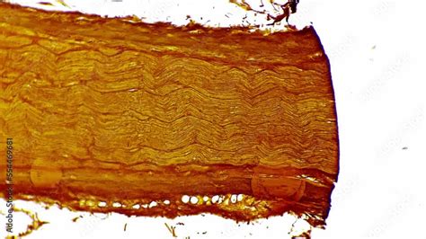 Silvering pattern of human nerves trunk in longitudinal section under ...