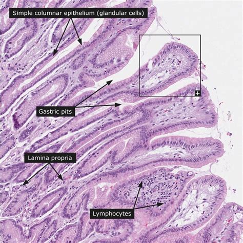 Stomach histology - gastric pits in 2021 | Tissue biology, Medical ...