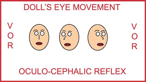 DOLL'S EYE MOVEMENT ,OCULO-CEPHALIC REFLEX,VESTIBULO-OCULAR REFLEX ...