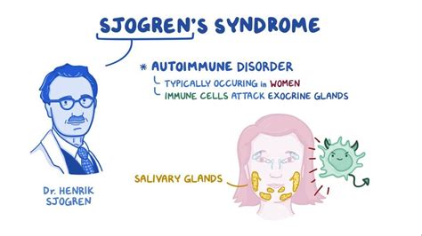 Discover the link between dry eyes and Sjögren's syndrome.