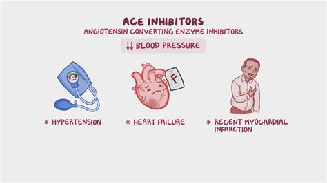 Ace Inhibitors Nursing Considerations, 55% OFF