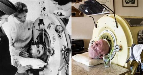 Paul Alexander, The Man Who's Been In An Iron Lung For 70 Years